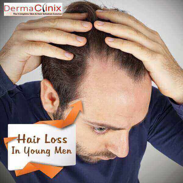 Facts About Hair Loss In Young Men