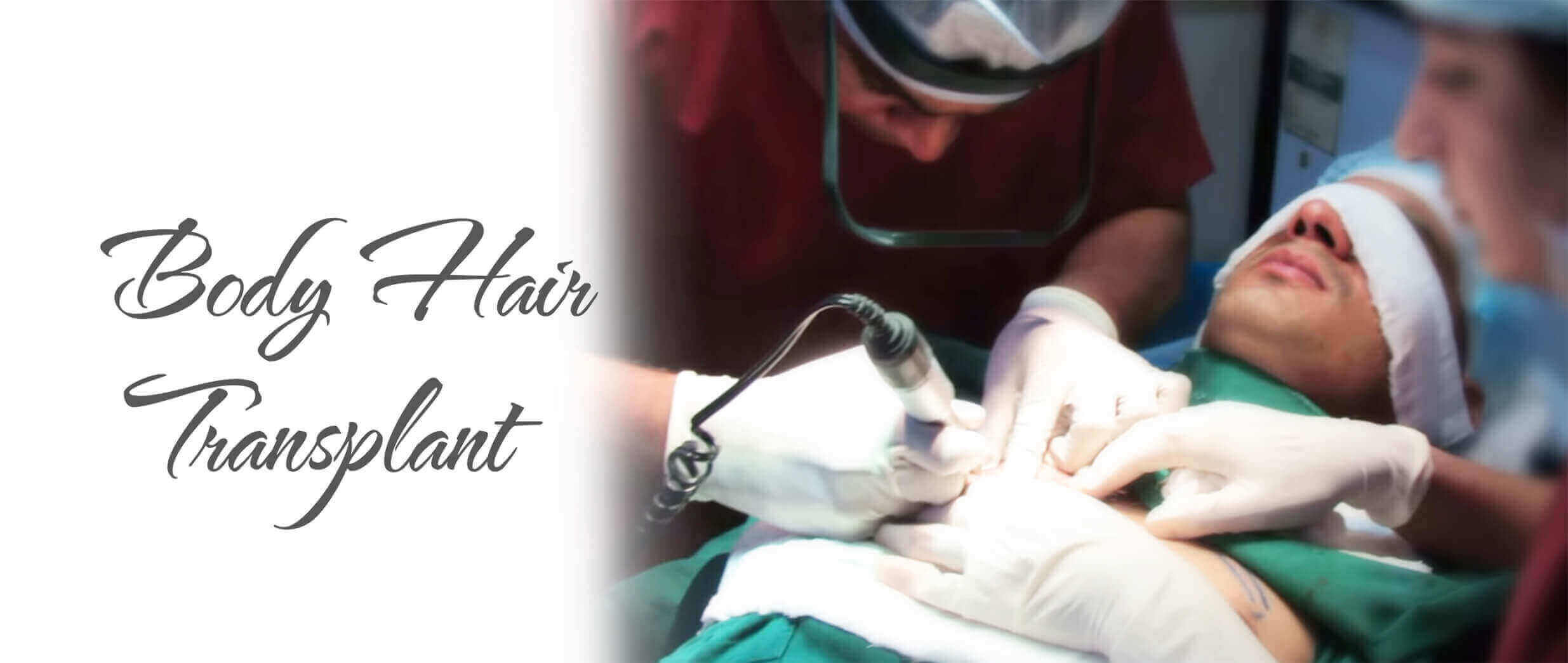 body hair transplant in delhi India