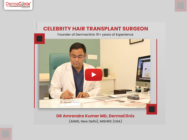 hair transplantation in Delhi