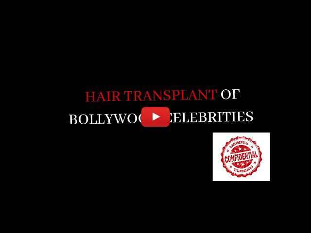 best hair transplant surgeon in Delhi
