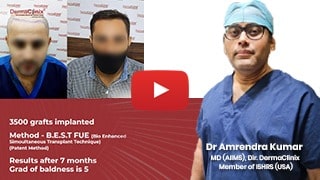 video testimonial for dr amrendra kumar