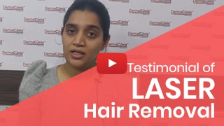 laser hair removal testimonial reviews