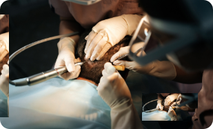 Procedure