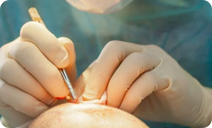 Procedure