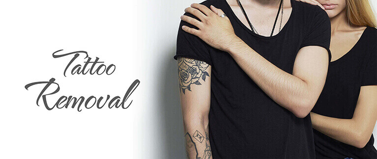 Permanent Laser Tattoo Removal in South Delhi