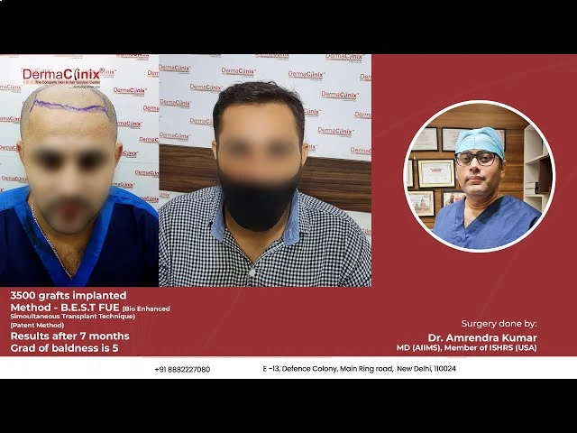 Video testimonial from a verified patient, six months post-op