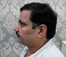 Patient after skin treatment