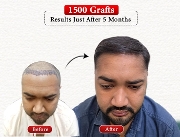 Before After Result