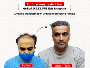 Before After Result