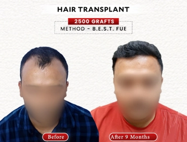 Before After Result