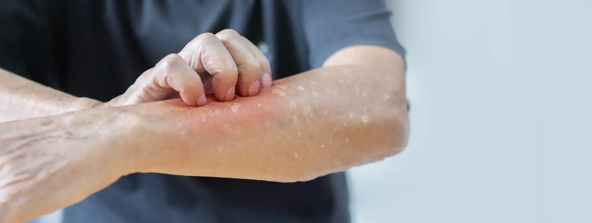 HD-PRP Therapy