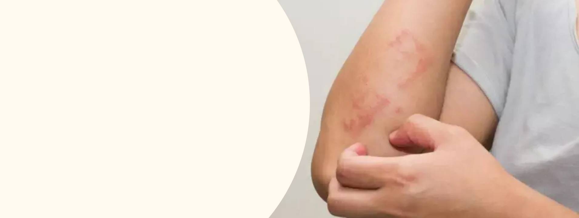 HD-PRP Therapy