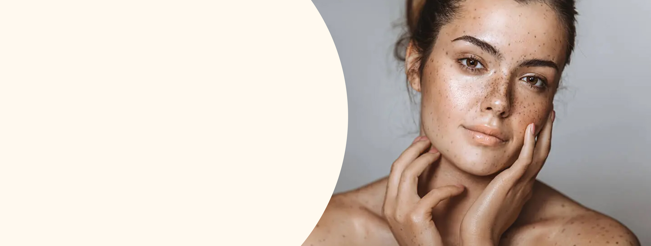 HD-PRP Therapy