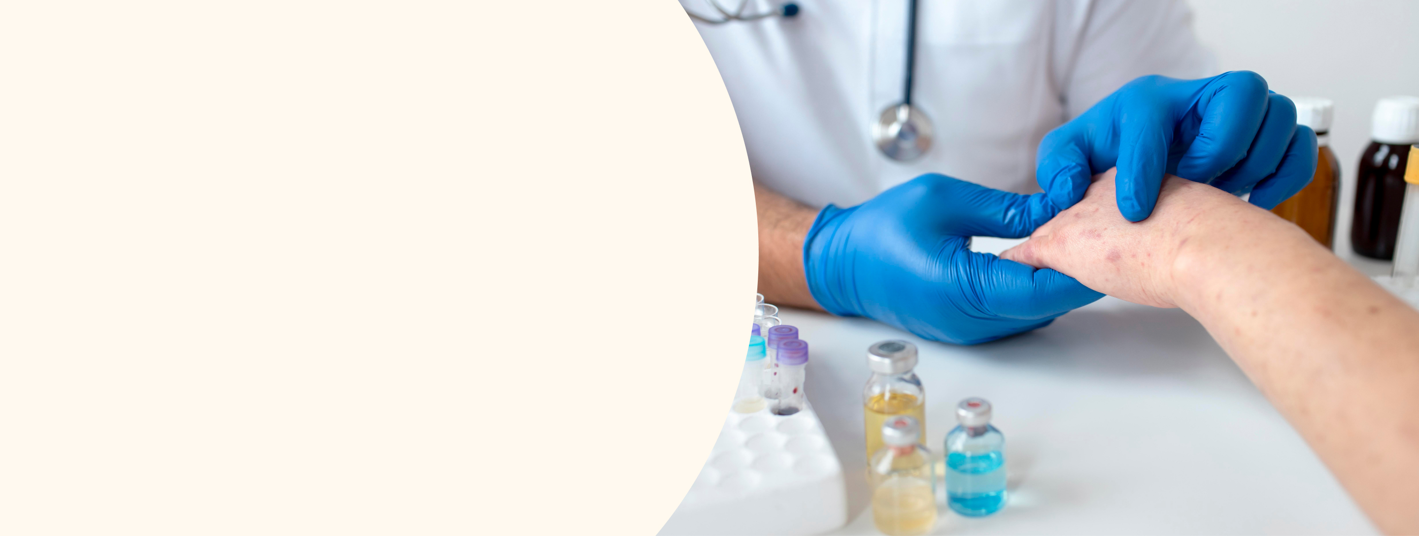 HD-PRP Therapy
