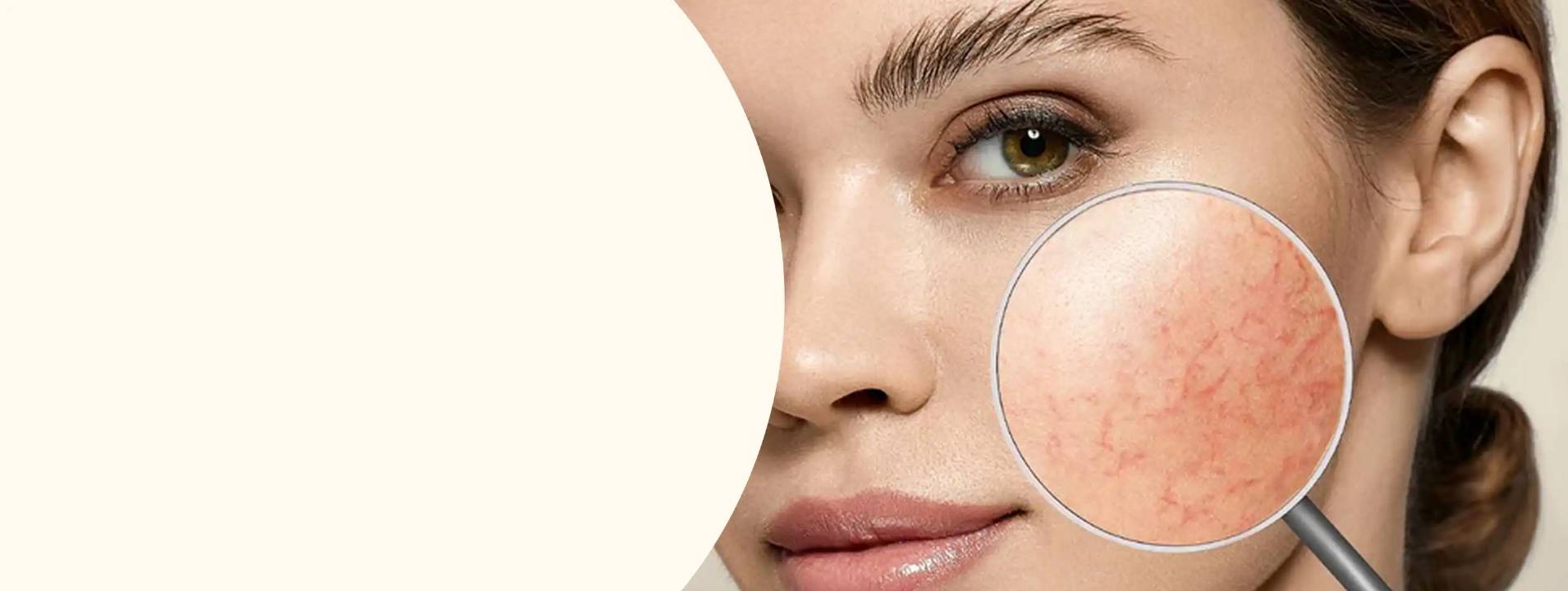 HD-PRP Therapy