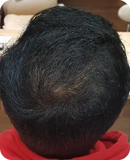 Before After Result